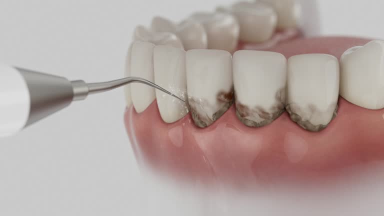 Trusted Dental Crowns And Bridges service in West Glendive, MT - Dentist Open Now